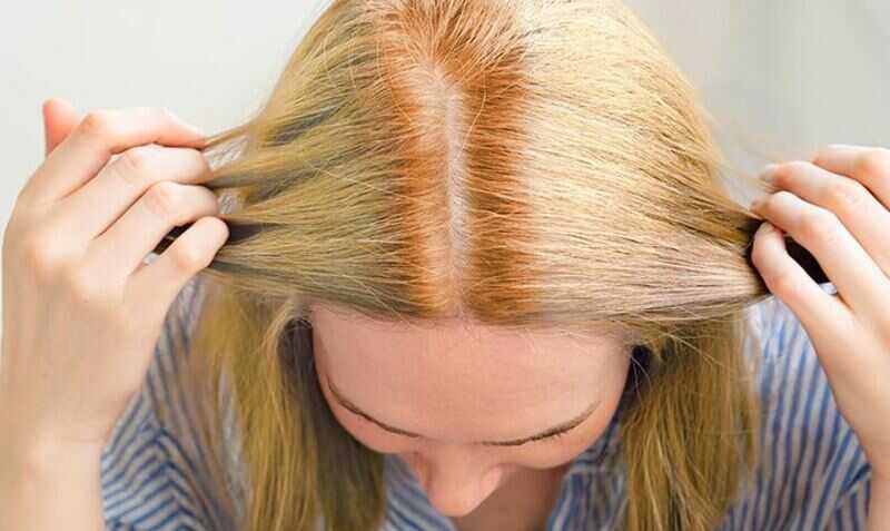 Are you figuring out how to fix patchy bleached hair and restore its natural beauty? (Source: Pinterest)